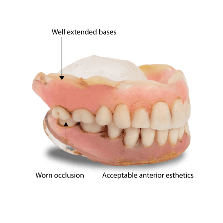 Denture Reference - AvaDent Digital Dental Solutions